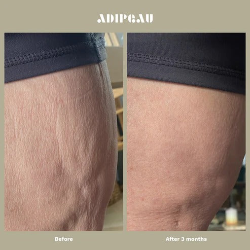 Adipeau - Strength Gel - 147.9ml