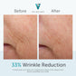 Factor Five - Anti-Aging Cream - 30g