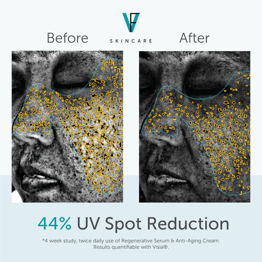 Factor Five - Anti-Aging Cream - 30g