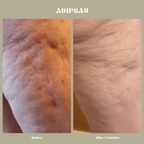 Adipeau - Strength Gel - 147.9ml