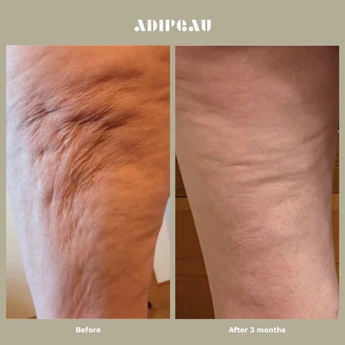 Adipeau - Strength Gel - 147.9ml