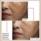 Cyspera Cysteamine Intensive Pigment 50g