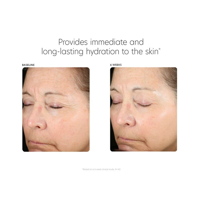 PCA SKIN - Hyaluronic Acid Boosting Serum - 30ml